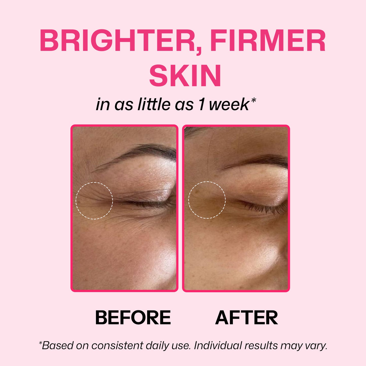 Segen PDRN Pink Peptide Face Serum | Brightening & Glow