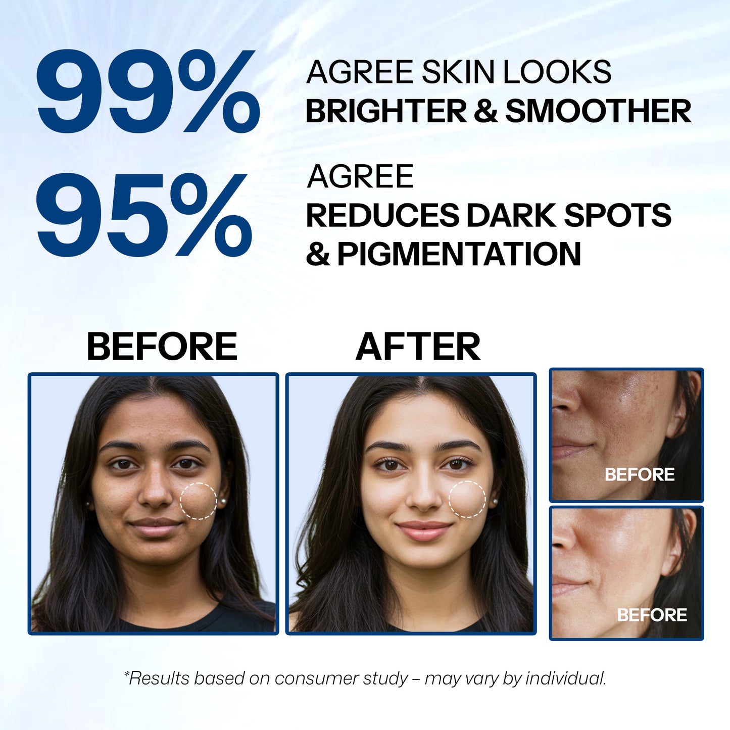 Segen Advanced Skin Brightening Face Cream with Tranexamic Acid 5%, Alpha Arbutin 7% & Niacinamide 5% | Brightens, Repairs & Evens Skin Tone | 30g