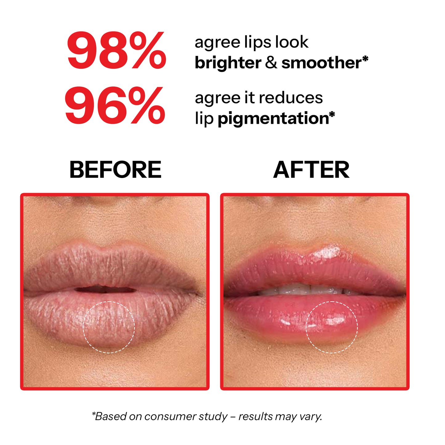 Lip Lightening Cream
