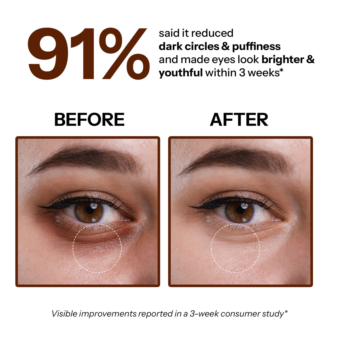 Under Eye Cream
