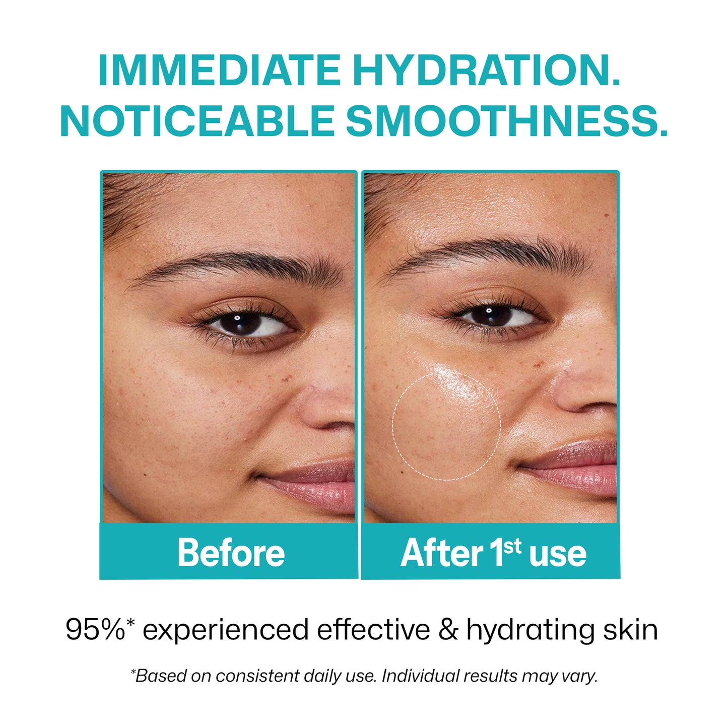 Segen PDRN Hyaluronic Acid Face Serum | Deep Hydration
