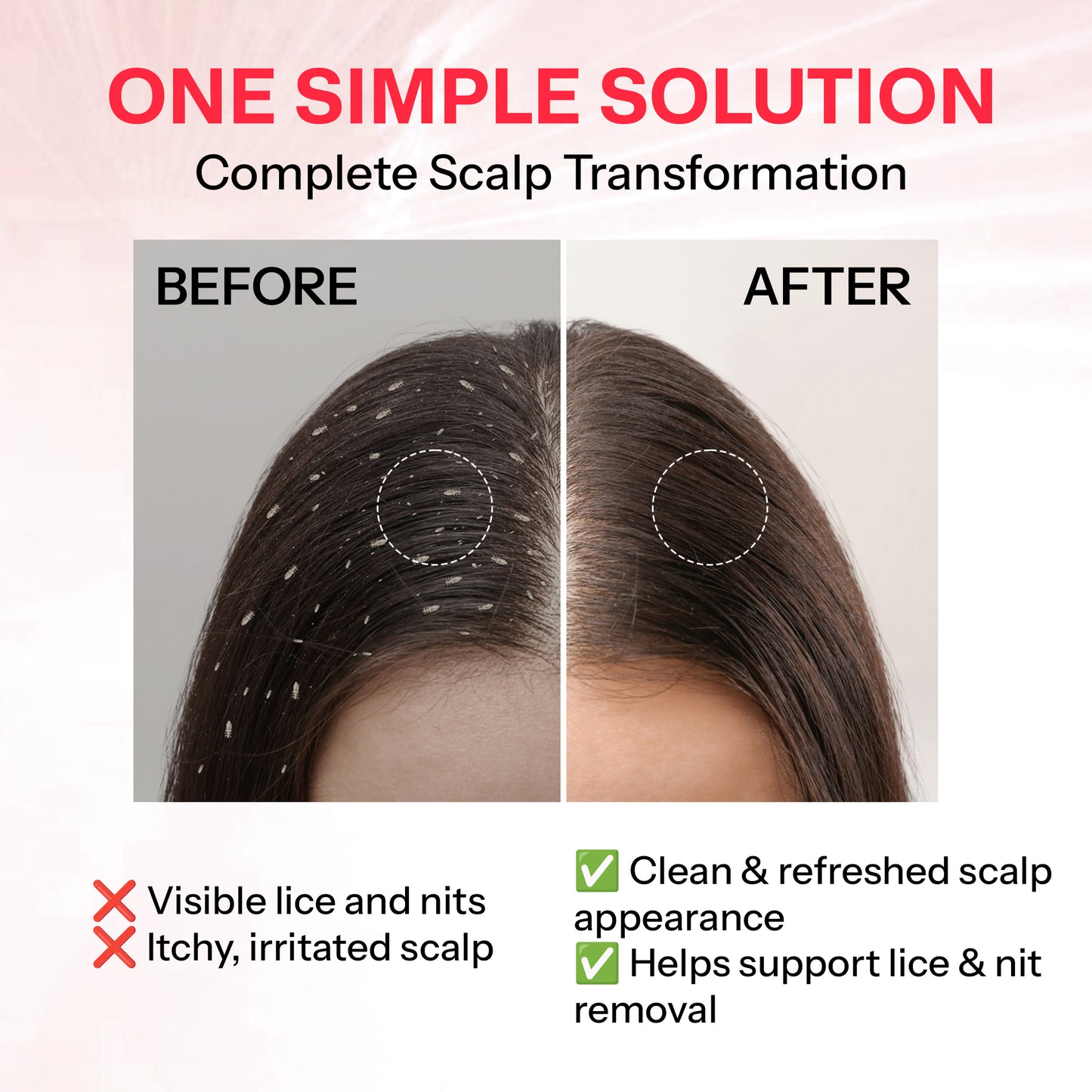 Segen NITSOL Anti-Lice Hair Shampoo | Scalp Comfort