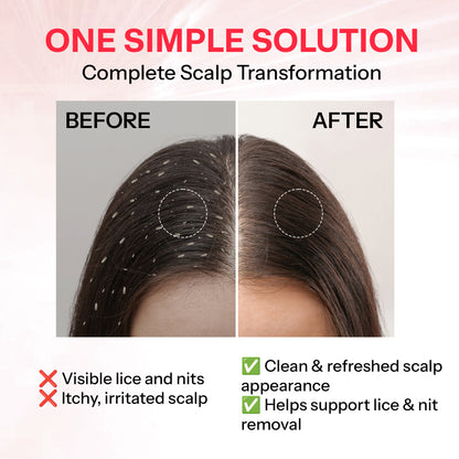 Segen NITSOL Anti-Lice Hair Shampoo | Scalp Comfort