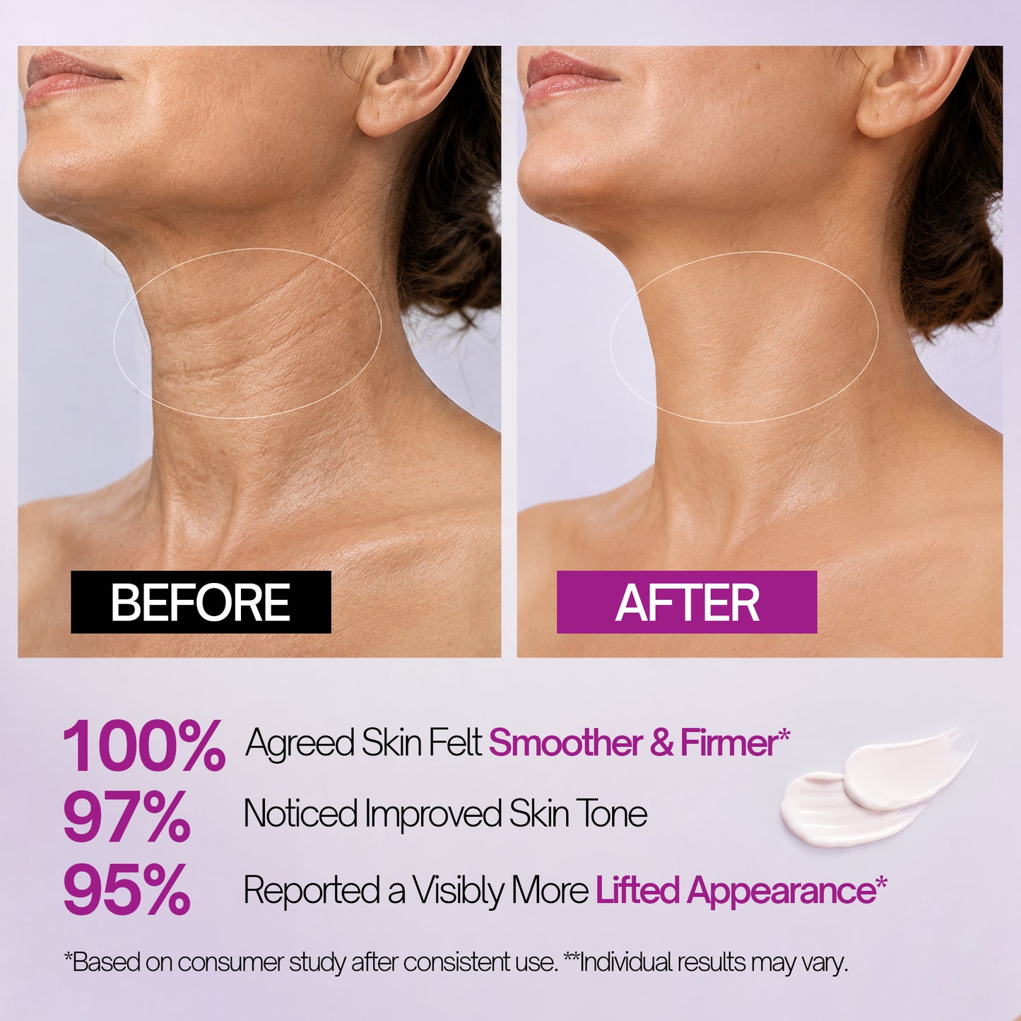 Segen Advanced Firming & Remodeling Neck Cream with Retinol, 5 Peptides, Collagen & Hyaluronic Acid | 50g