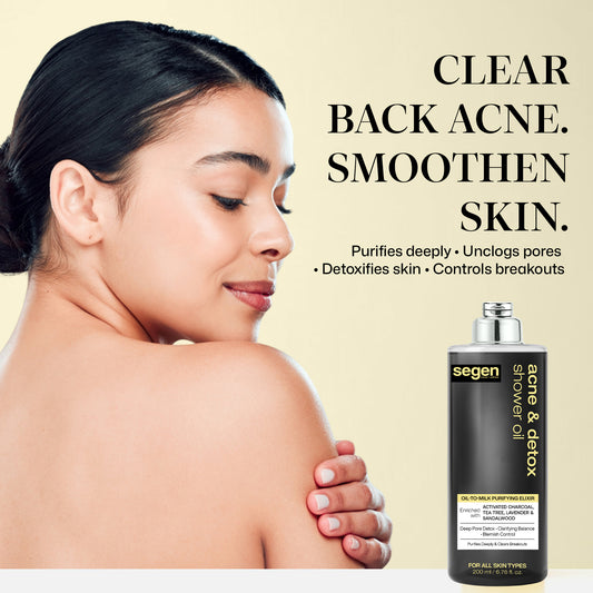 Segen Acne & Detox Shower Oil – Oil-to-Milk Purifying Cleanser with Activated Charcoal, Tea Tree & Sandalwood | Deep Pore Detox & Blemish Control - 200 ml