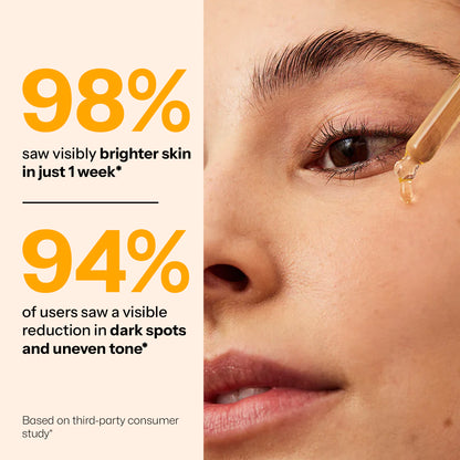 Segen Vitamin C 15% Brightening Serum with Alpha Arbutin, Ferulic Acid & Glutathione | Boosts Radiance, Collagen & Glow – 30ml