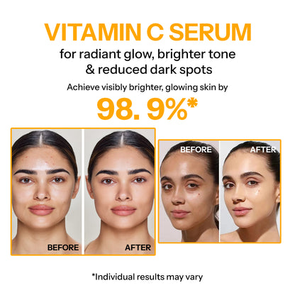 Segen Vitamin C Brightening Serum –With Glutathione, Ferulic Acid, Vitamin E & Green Tea (30ml)