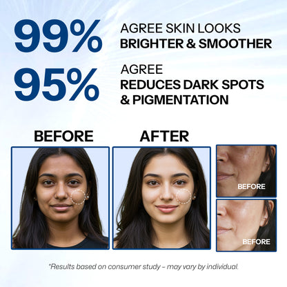 Segen Advanced Skin Brightening Face Cream with Tranexamic Acid 5%, Alpha Arbutin 7% & Niacinamide 5% | Brightens, Repairs & Evens Skin Tone | 30g