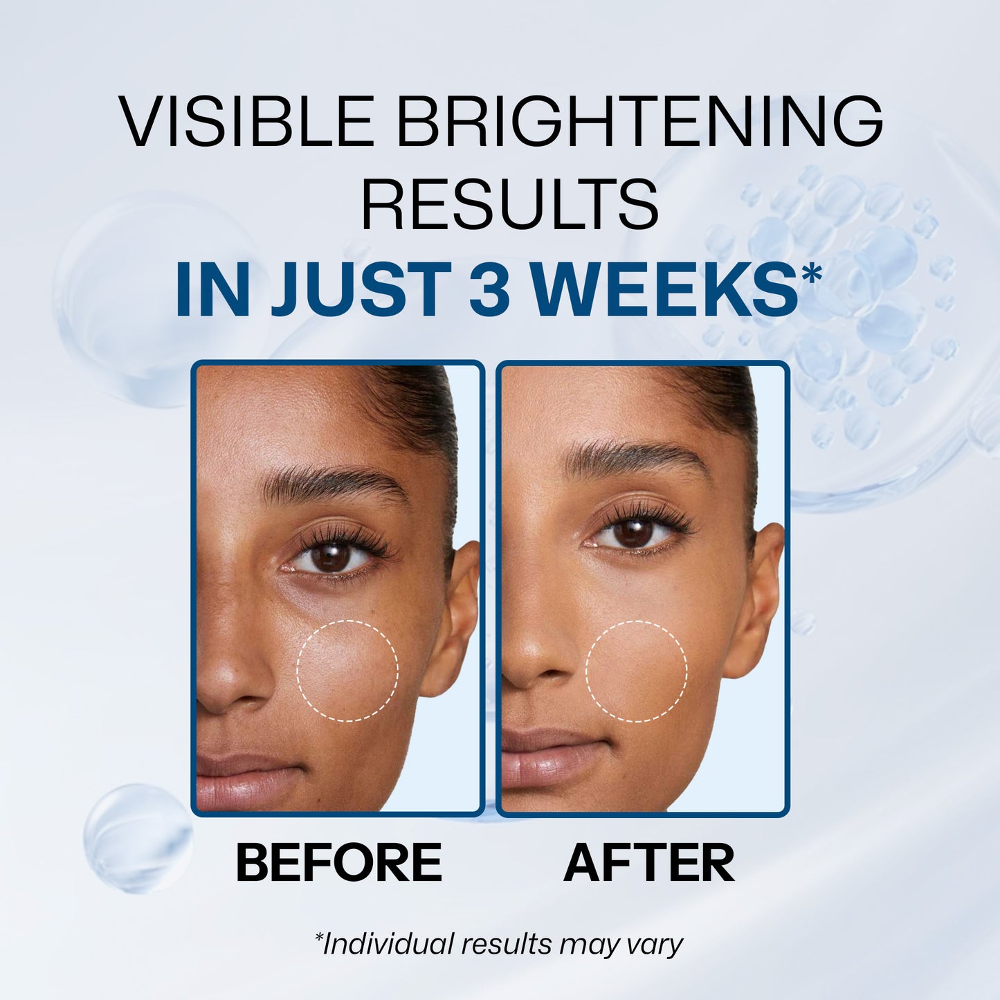 Segen Kojic Acid 2% Dark Spot Correcting Face Serum-30ml