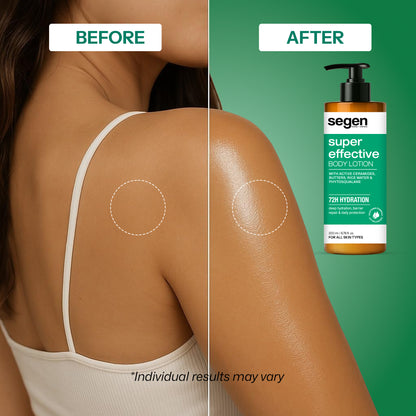 Segen Super Effective Body Lotion – 72H Deep Hydration with Ceramides, Butters, Rice Water & Phytosqualane | For All Skin Types