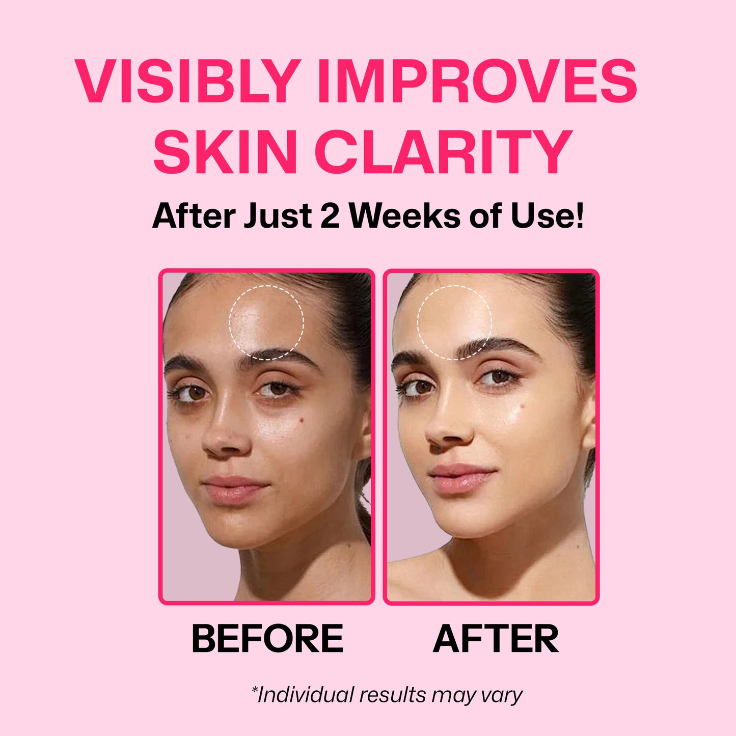 Segen Radiance Boost Face Serum with TXA 5% & Niacinamide 10% | Brightens Skin, Evens Tone & Fades Dark Spots