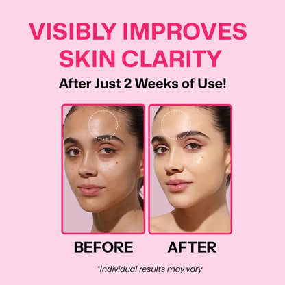 Segen Radiance Boost Face Serum with TXA 5% & Niacinamide 10% | Brightens Skin, Evens Tone & Fades Dark Spots