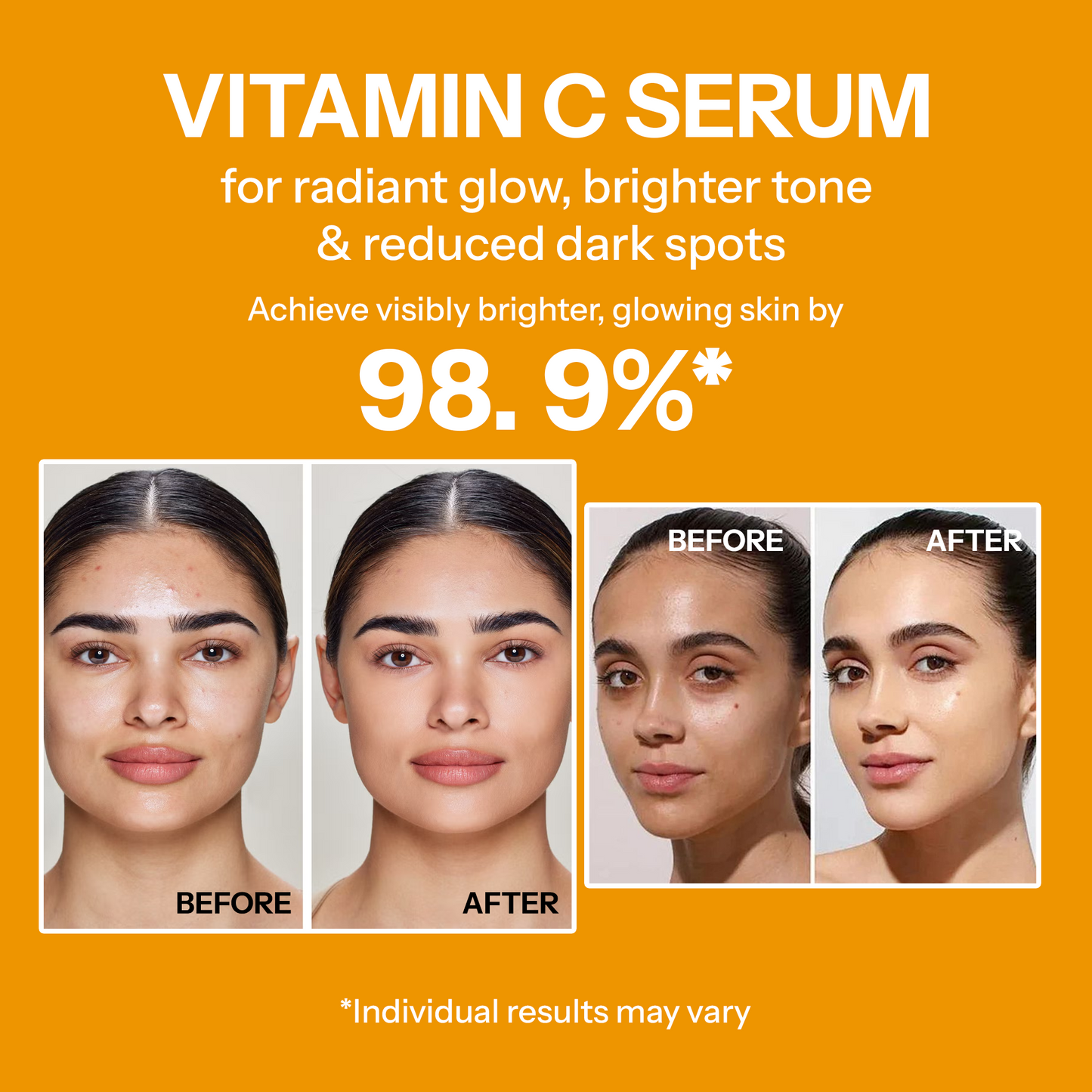 Segen Vitamin C 15% Brightening Serum with Alpha Arbutin, Ferulic Acid & Glutathione | Boosts Radiance, Collagen & Glow – 30ml